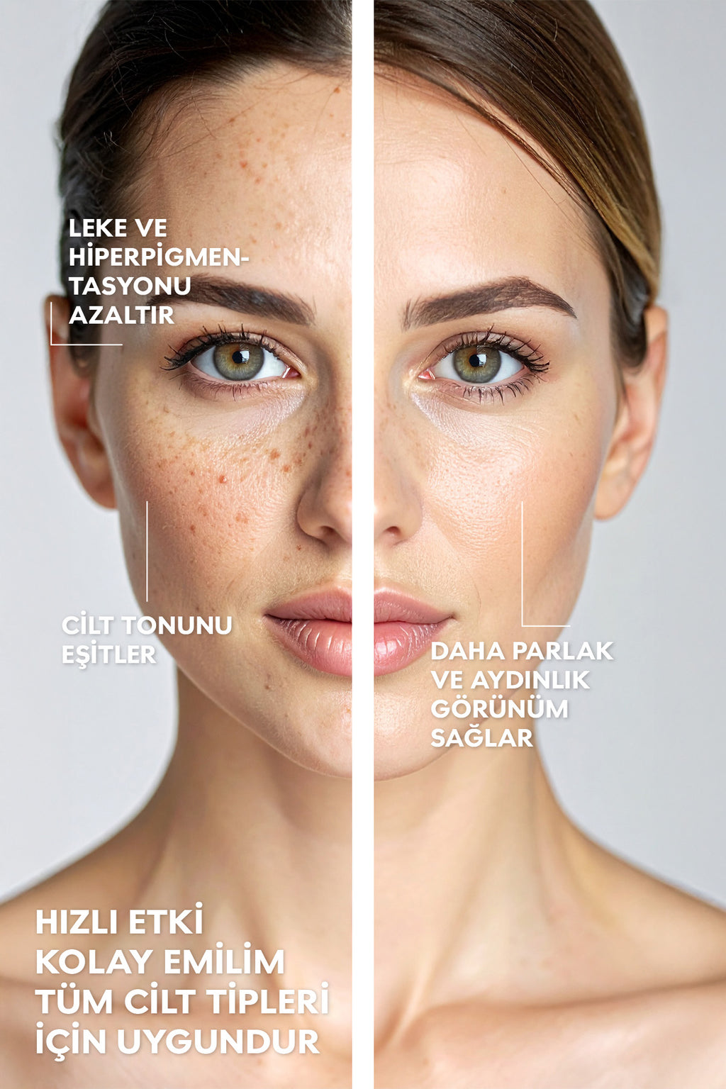 Arbutin Serum %2 Alfa Arbutin + Niasinamid Elma Özlü Leke Karşıtı & Ton Eşitleyici 30ml