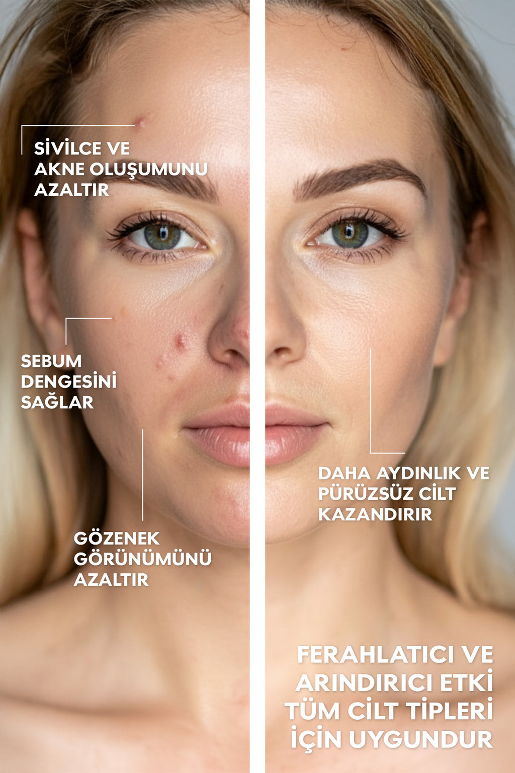 Cilt Yenileyici Tonik %5 Glikolik Asit Elma Özlü Gözenek Sıkılaştırıcı & Sebum Dengesi 200ml